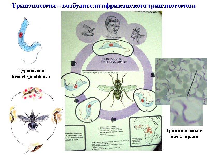 Трипаносомы – возбудители африканского трипаносомоза Trypanosoma brucei gambiense Трипаносомы в мазке крови